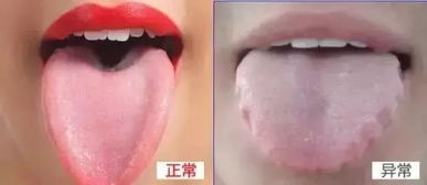 舌头疼像被烫的感觉,可能有多种原因。以下是一些可能的原因及建议 舌头疼像被烫的感觉,可能有多种原因。以下是一些可能的原因及建议