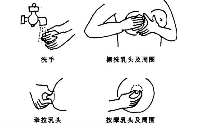 乳头一直翘起来可能是由多种原因引起的。以下是其中一些可能的原因 乳头一直翘起来可能是由多种原因引起的。以下是其中一些可能的原因